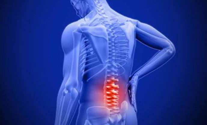 Can ankylosing spondylitis be cured? Treatment